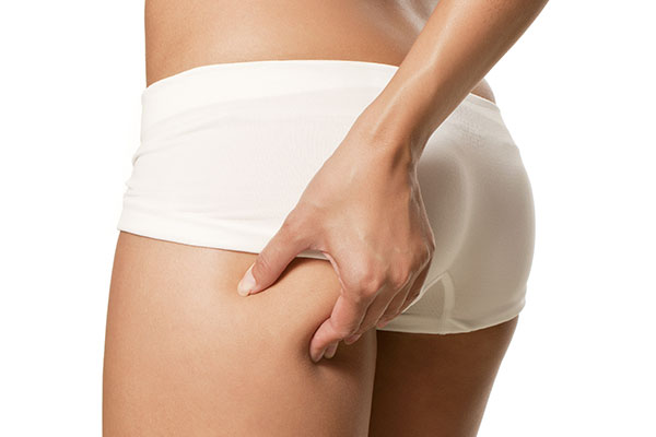 FUPA Liposuction Sacramento